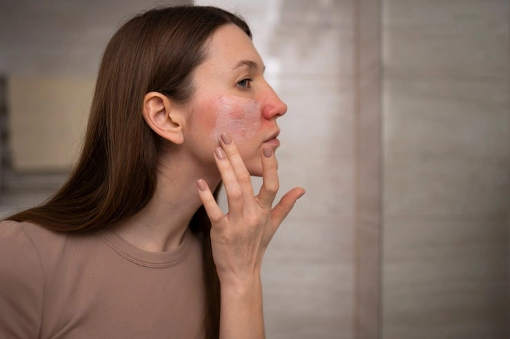 Understanding Dehydrated Skin vs Dry Skin